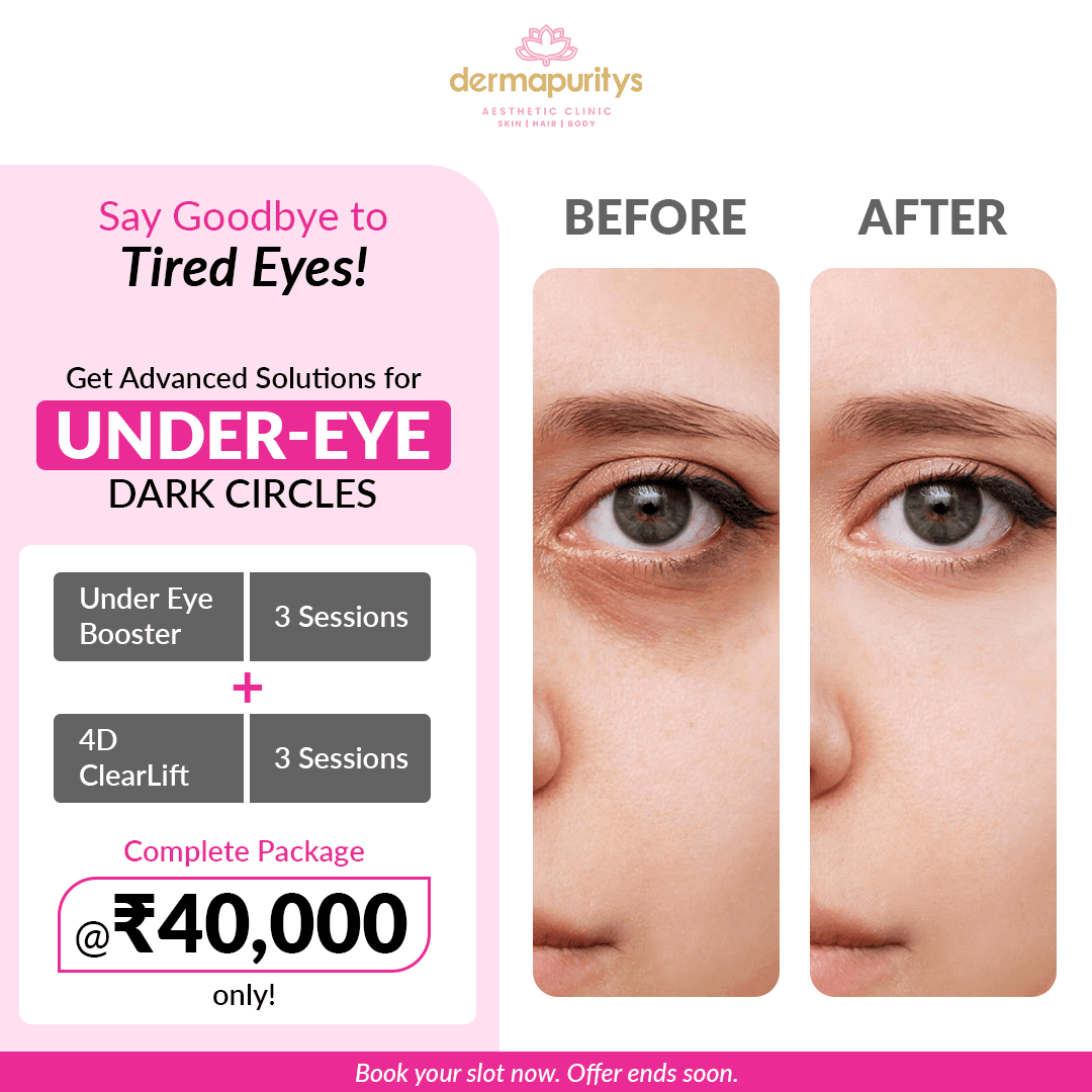 offer_image_9