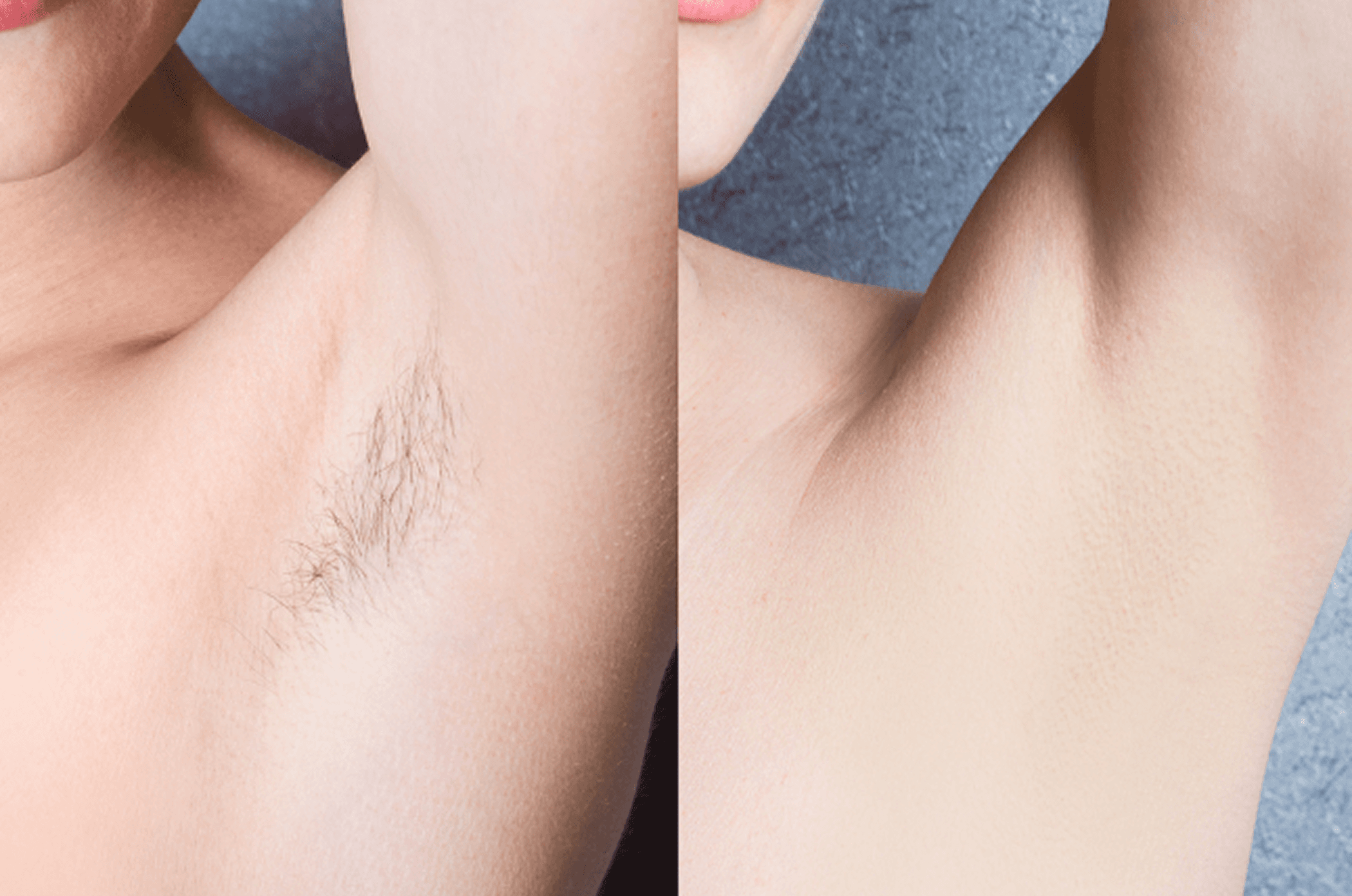 before-after-0