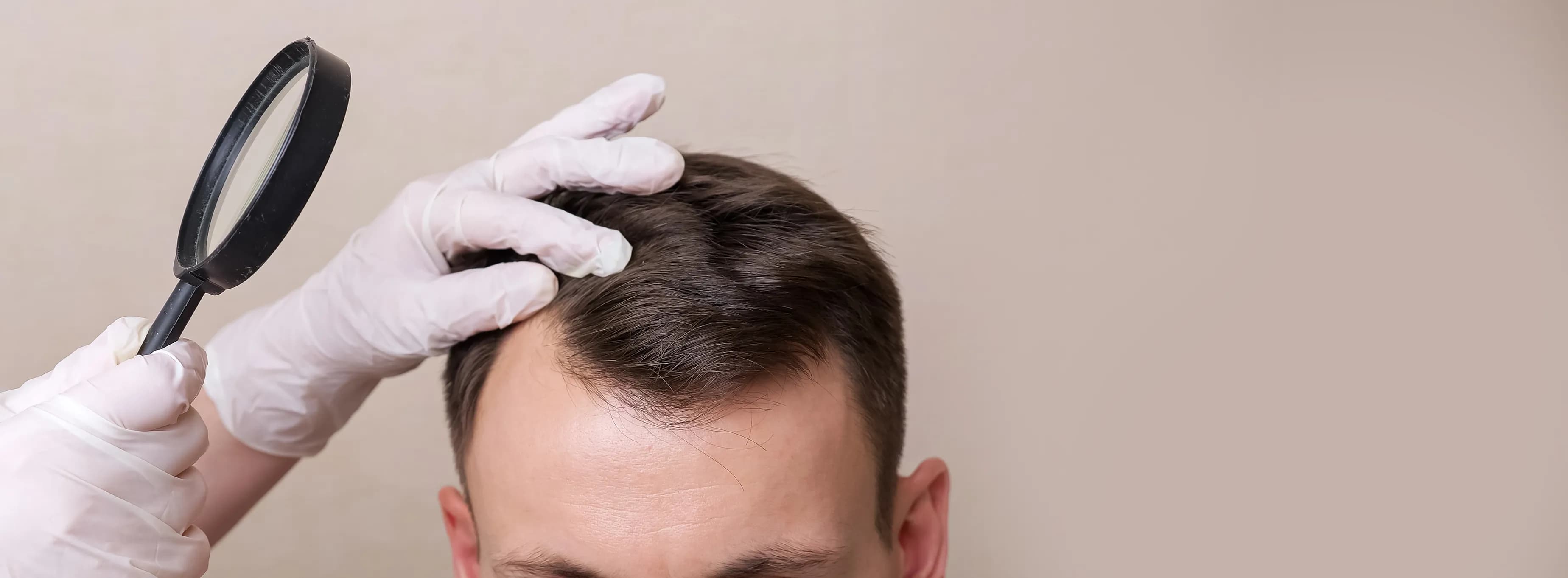 Advanced Hair Transplant