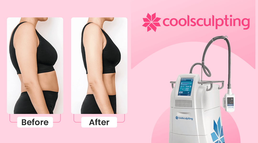 Anti-aging treatments demonstration showing a woman's face with circular callouts highlighting different skin areas