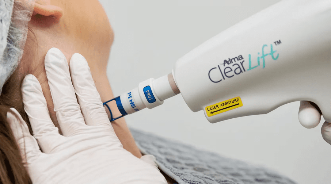 4D ClearLift Treatment in Delhi - Dermapuritys
