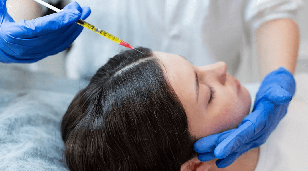 Best Hair Loss Treatments in India - Dermapuritys