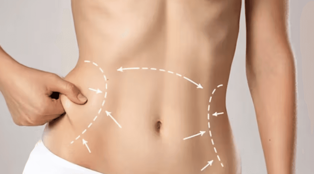 Anti-aging treatments demonstration showing a woman's face with circular callouts highlighting different skin areas