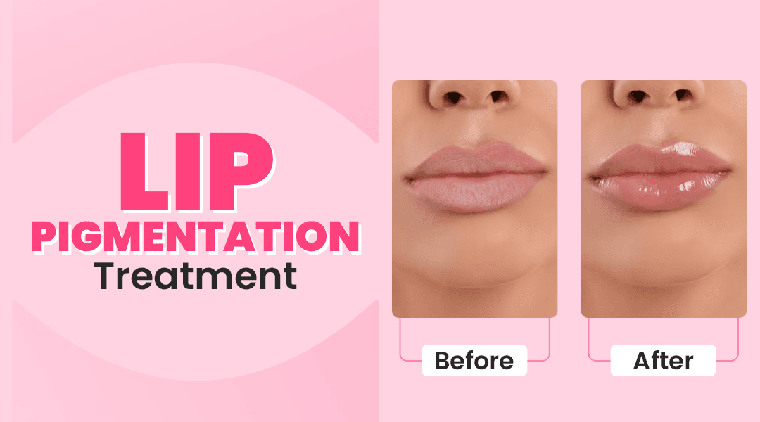 Anti-aging treatments demonstration showing a woman's face with circular callouts highlighting different skin areas