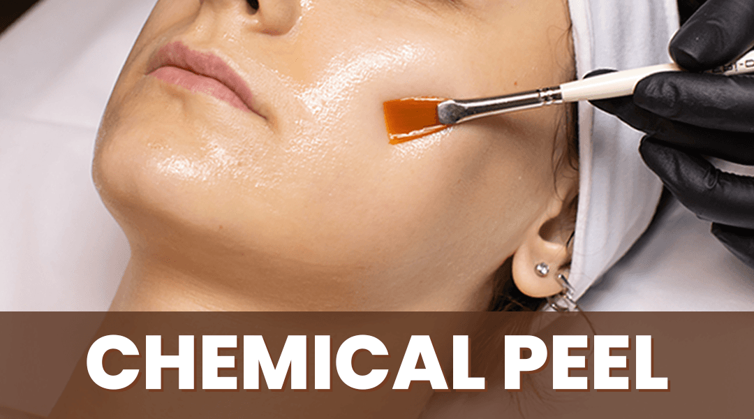Anti-aging treatments demonstration showing a woman's face with circular callouts highlighting different skin areas