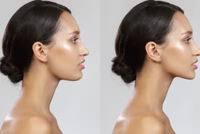 before-after-2