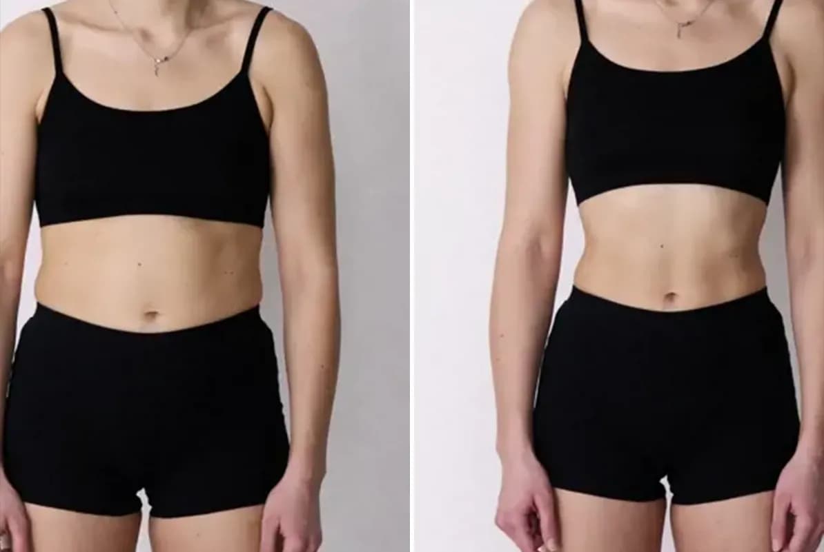 before-after-0