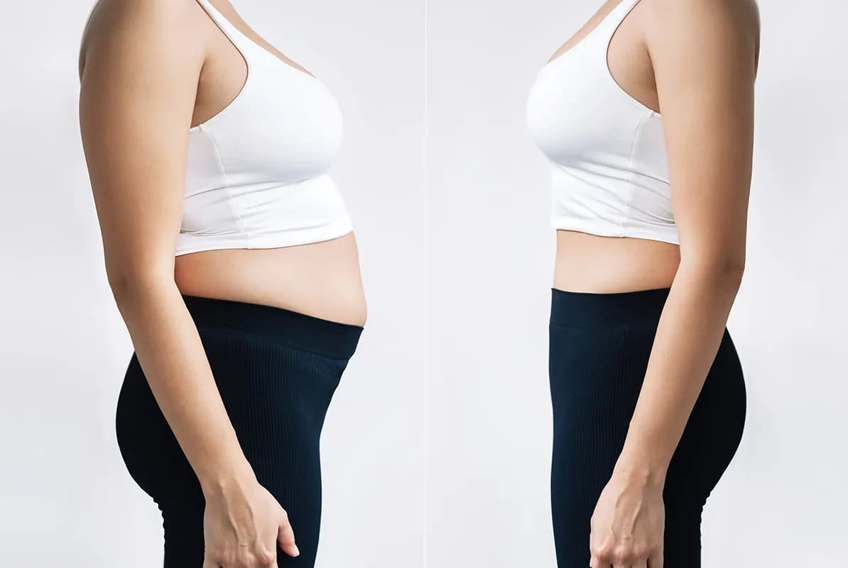 before-after-2
