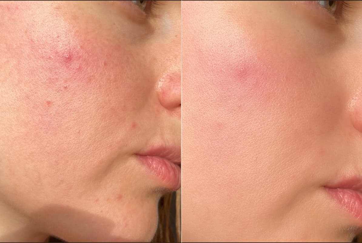 before-after-0