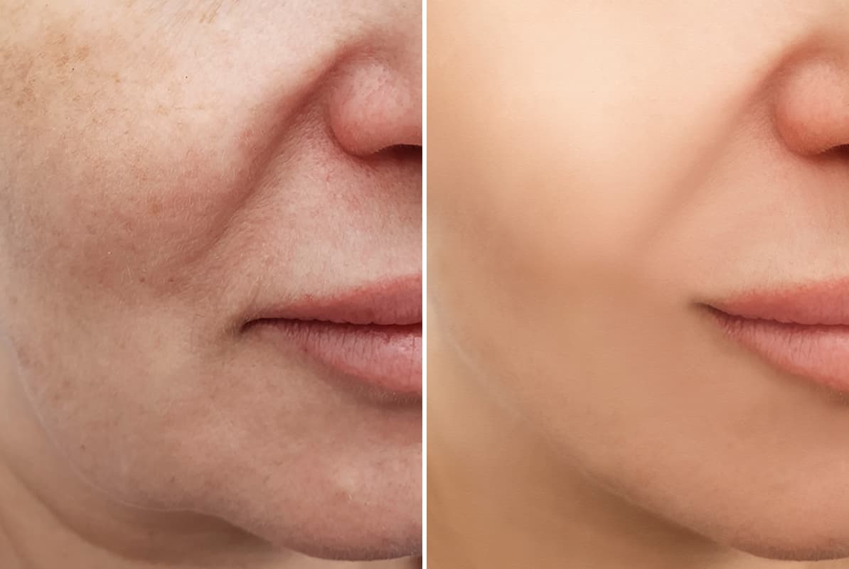 before-after-1