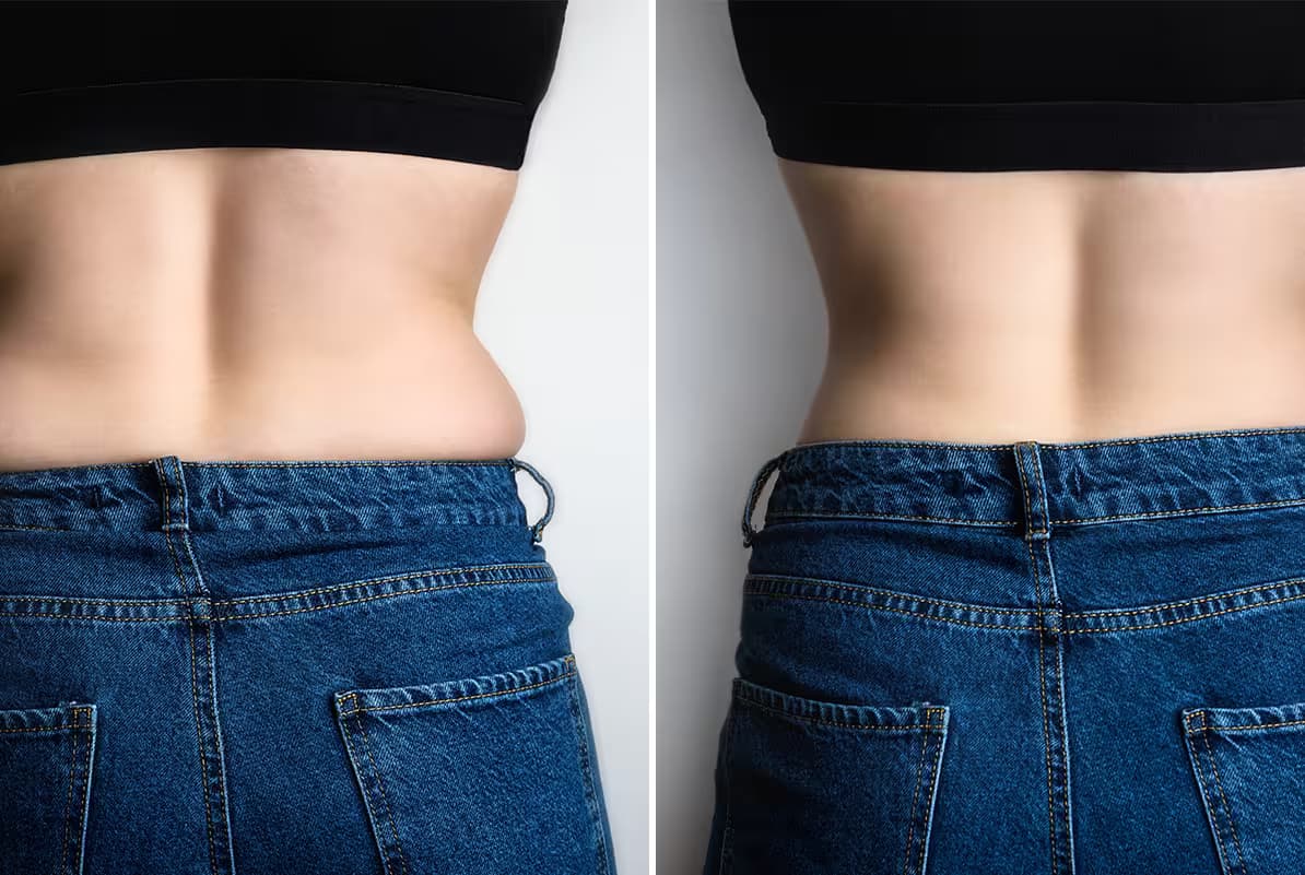 before-after-1