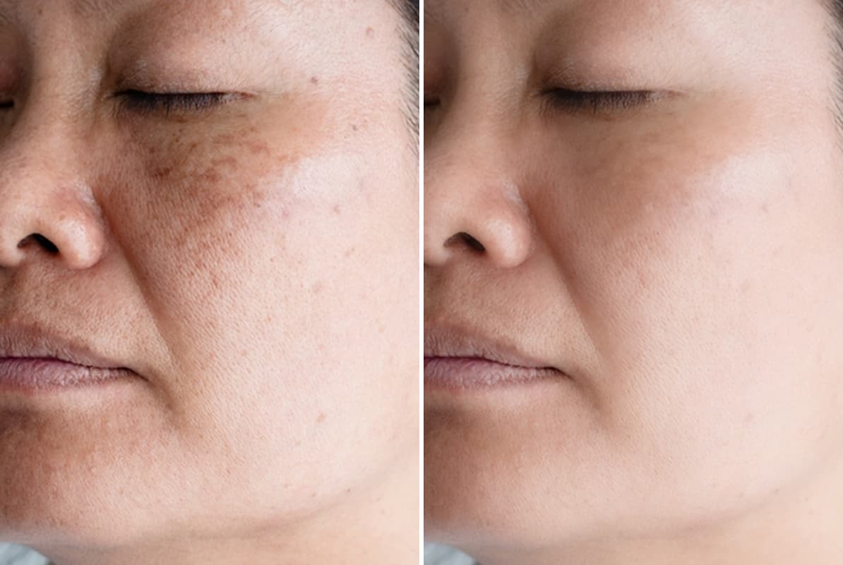 before-after-1