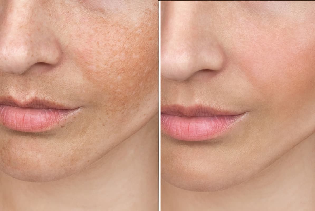 before-after-2