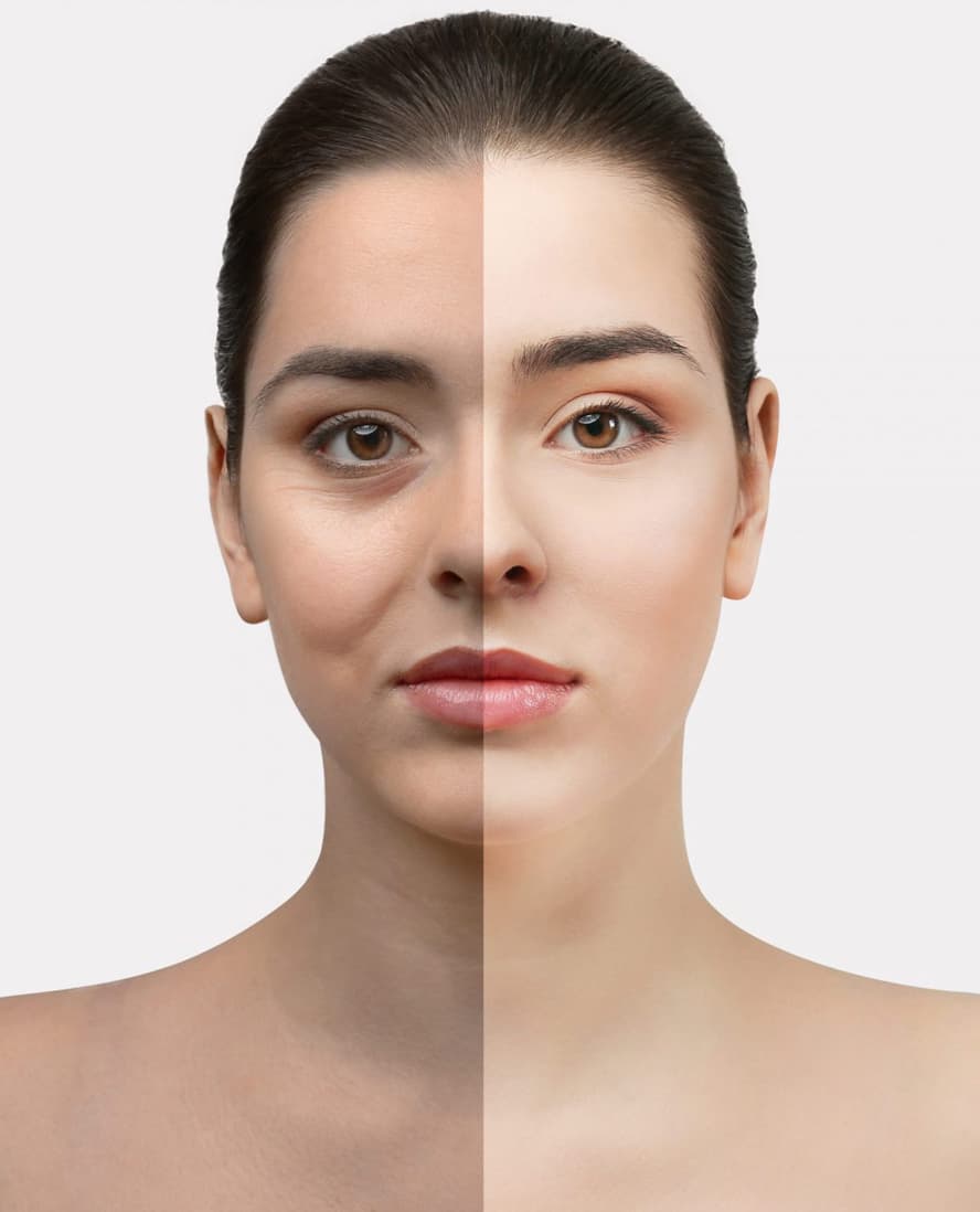 Improves Uneven Skin Tone