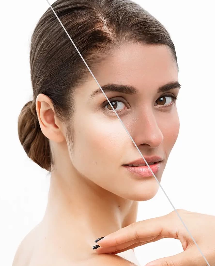 Brightens Dull-Looking Skin