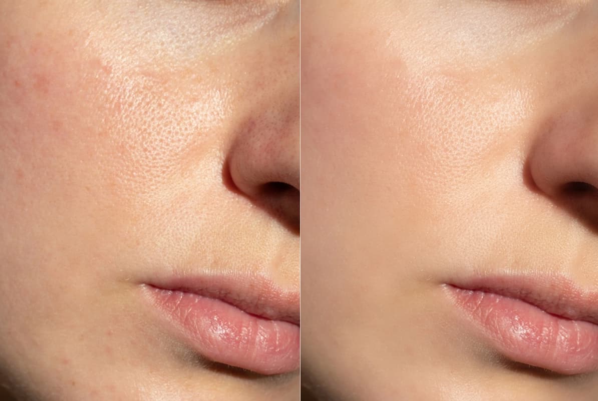 before-after-0