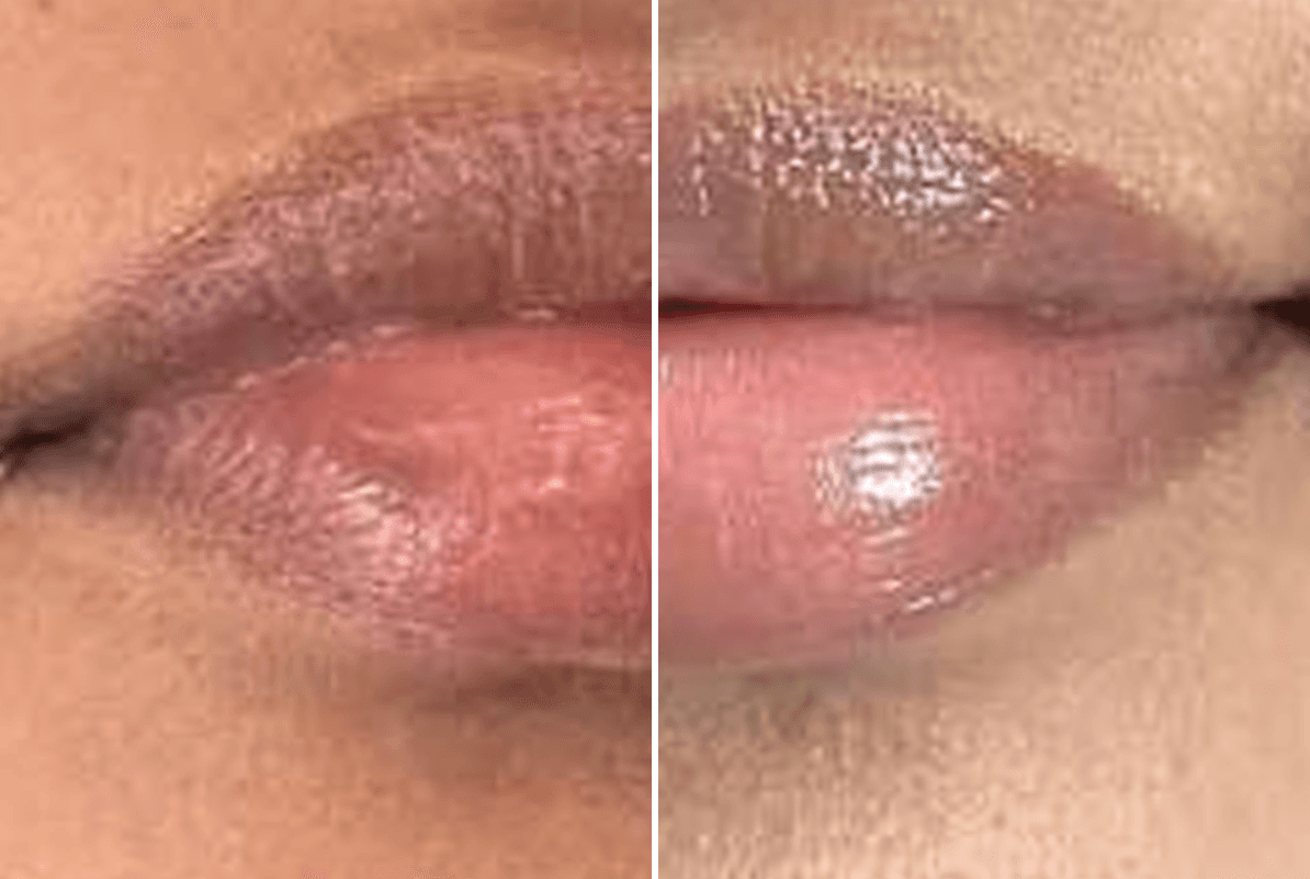 before-after-1