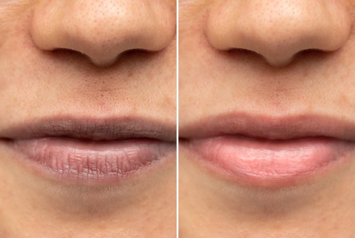 before-after-0