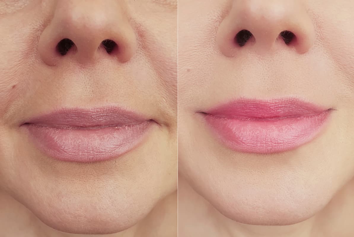 before-after-2