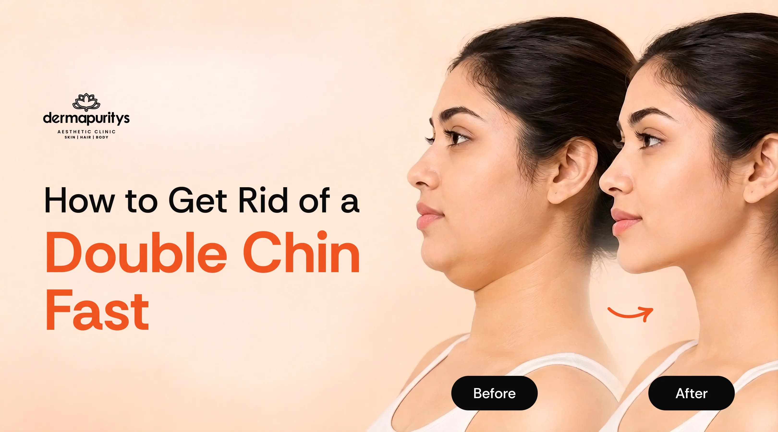 Anti-aging treatments demonstration showing a woman's face with circular callouts highlighting different skin areas
