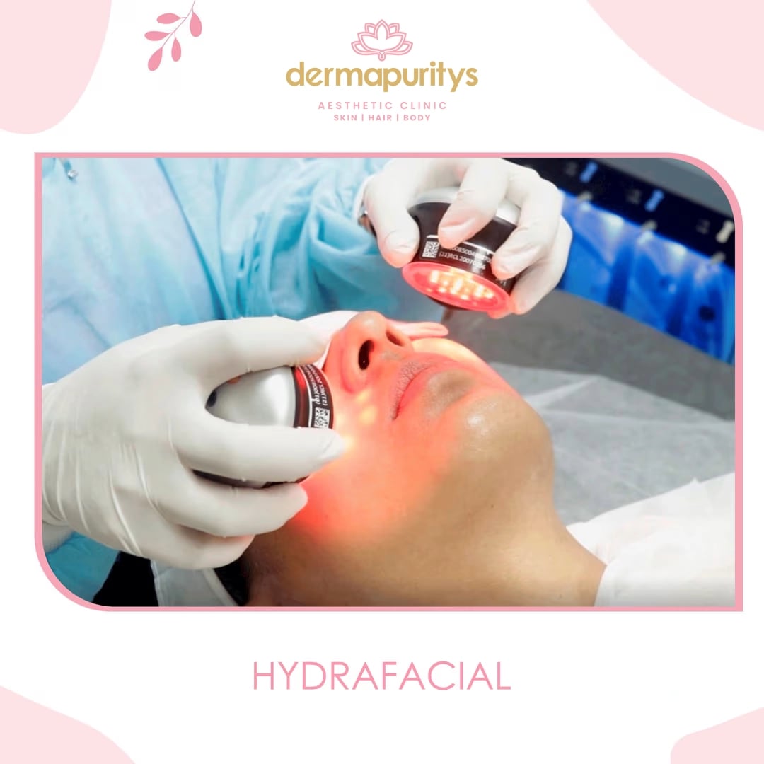 50% Off - Skin Treatment at Dermapuritys