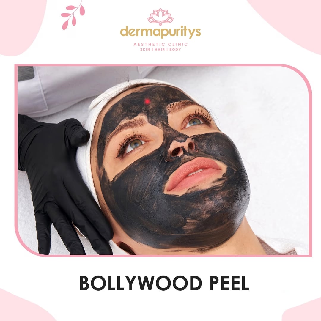 Get upto 50% Off - Skin Treatment at Dermapuritys