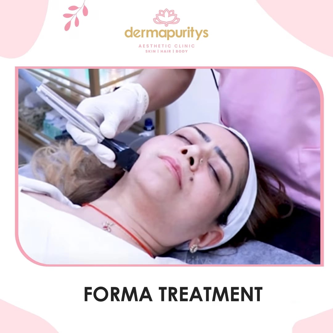 50% Off - Skin Treatment at Dermapuritys