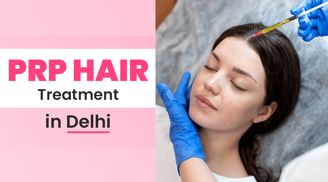 Everything You Need to Know About PRP Hair Treatment
