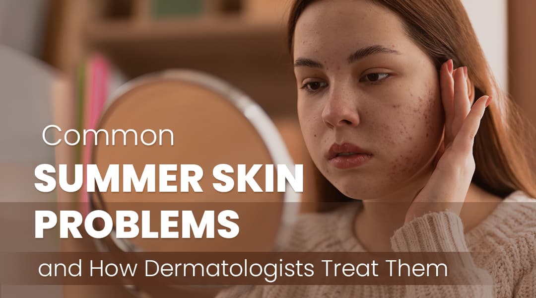 Common Summer Skin Problems and How Dermatologists Treat Them