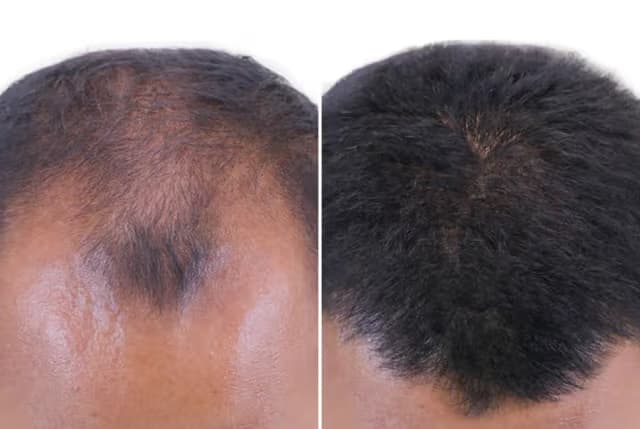 before-after-1