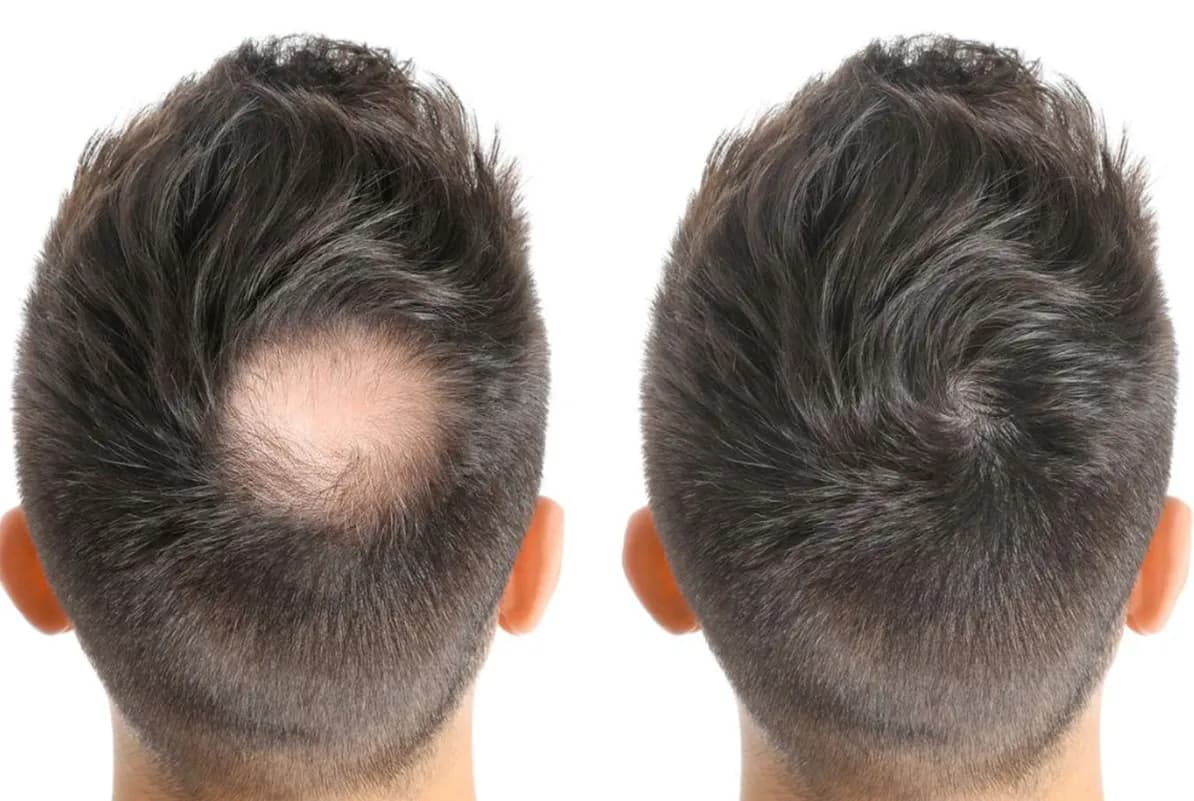 before-after-2