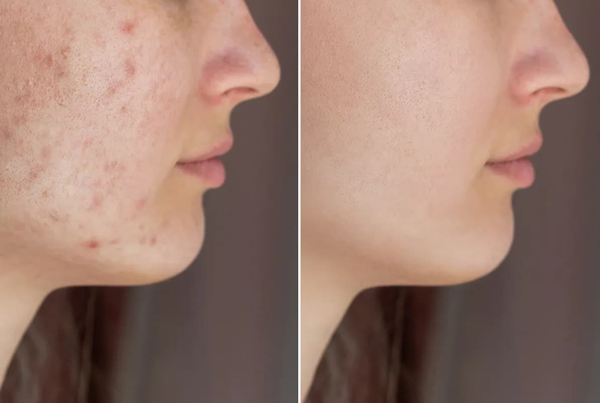 before-after-1