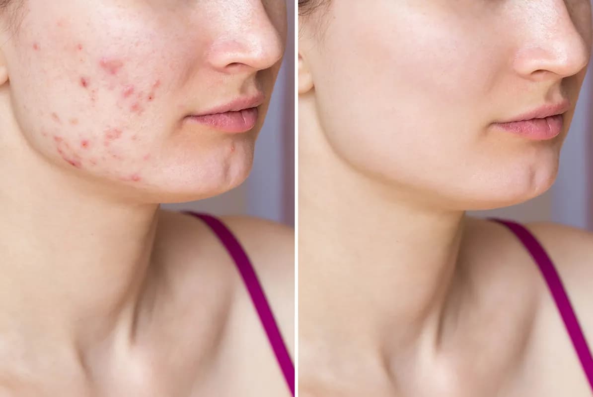 before-after-2