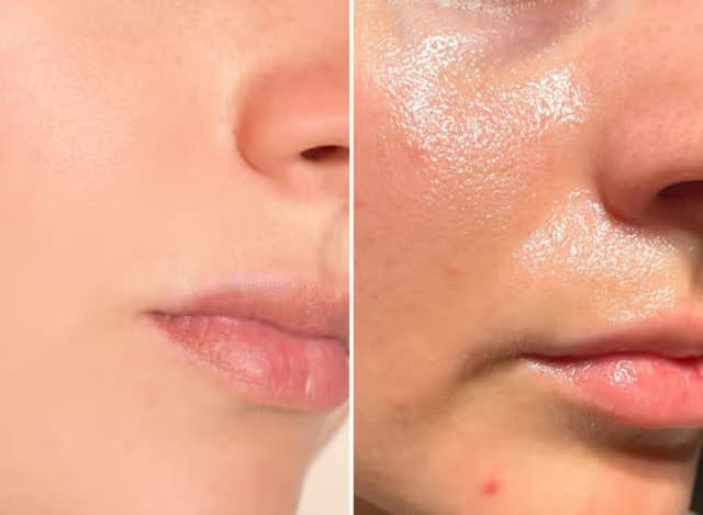 before-after-2