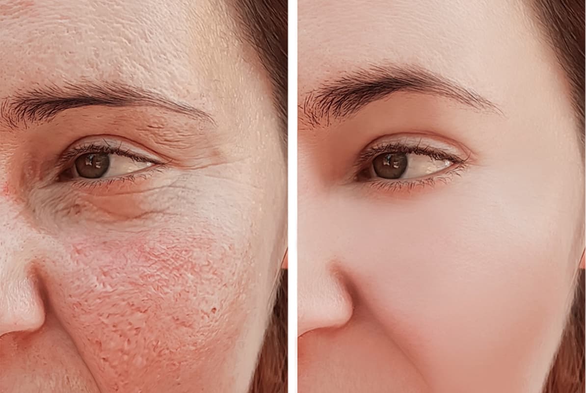 before-after-0