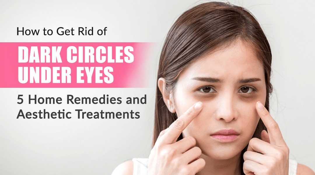 How to Get Rid of Dark Circles Under Eyes: 5 Home Remedies and Aesthetic Treatments